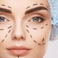 Is it safe to get plastic surgery in another country?