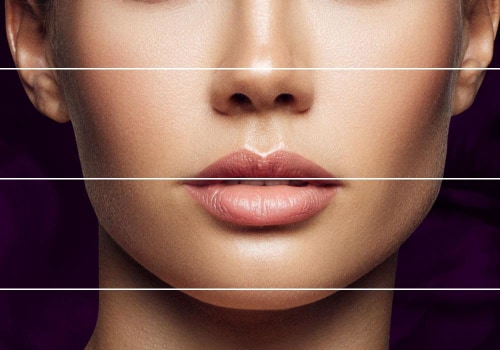 Do fillers make you more attractive?