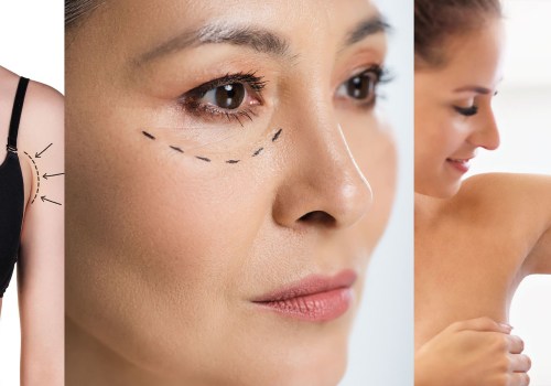 What is the most common aesthetic procedure?