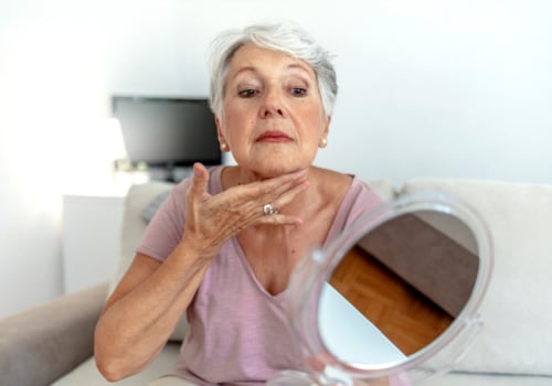 How long does it take for nerves to heal after a facelift?